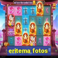 eritema fotos